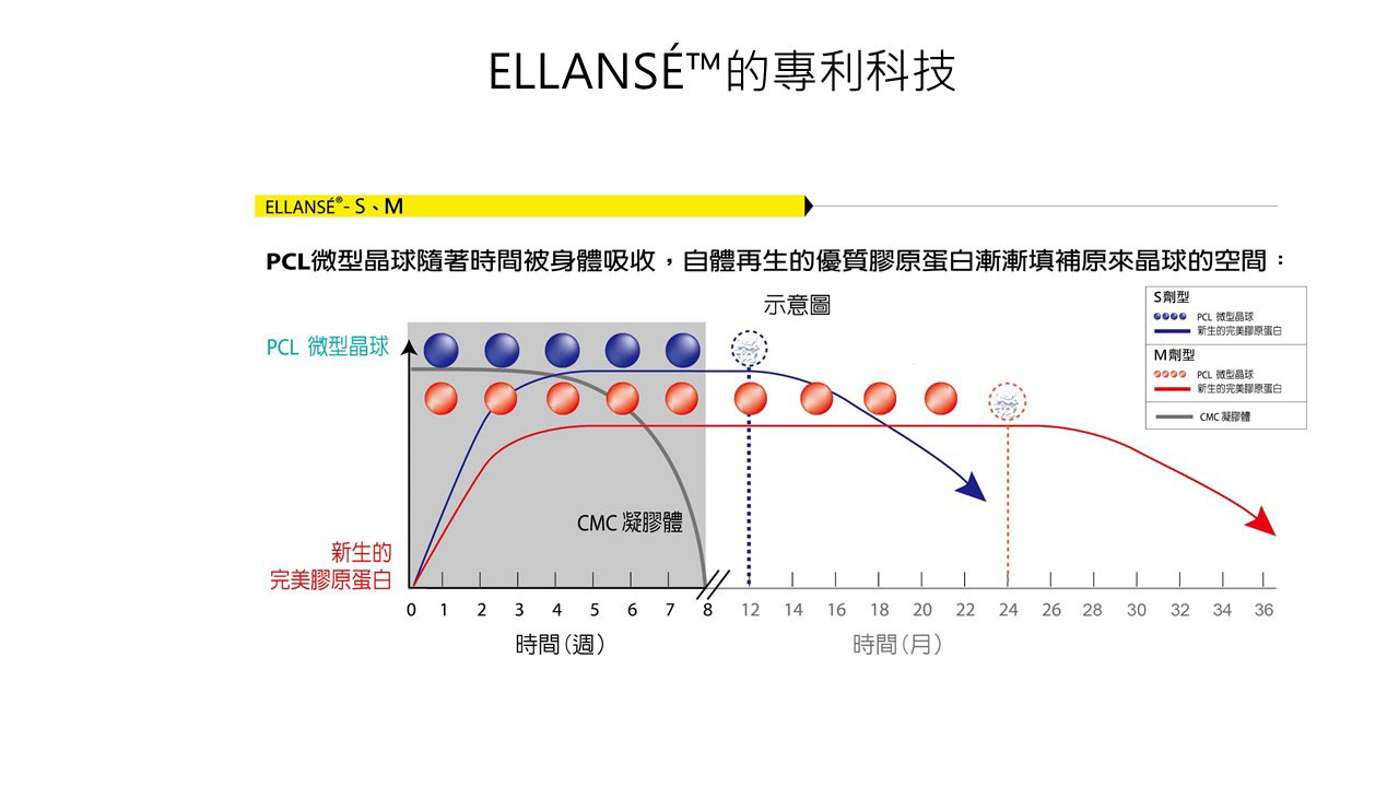 Ellanse 少女針