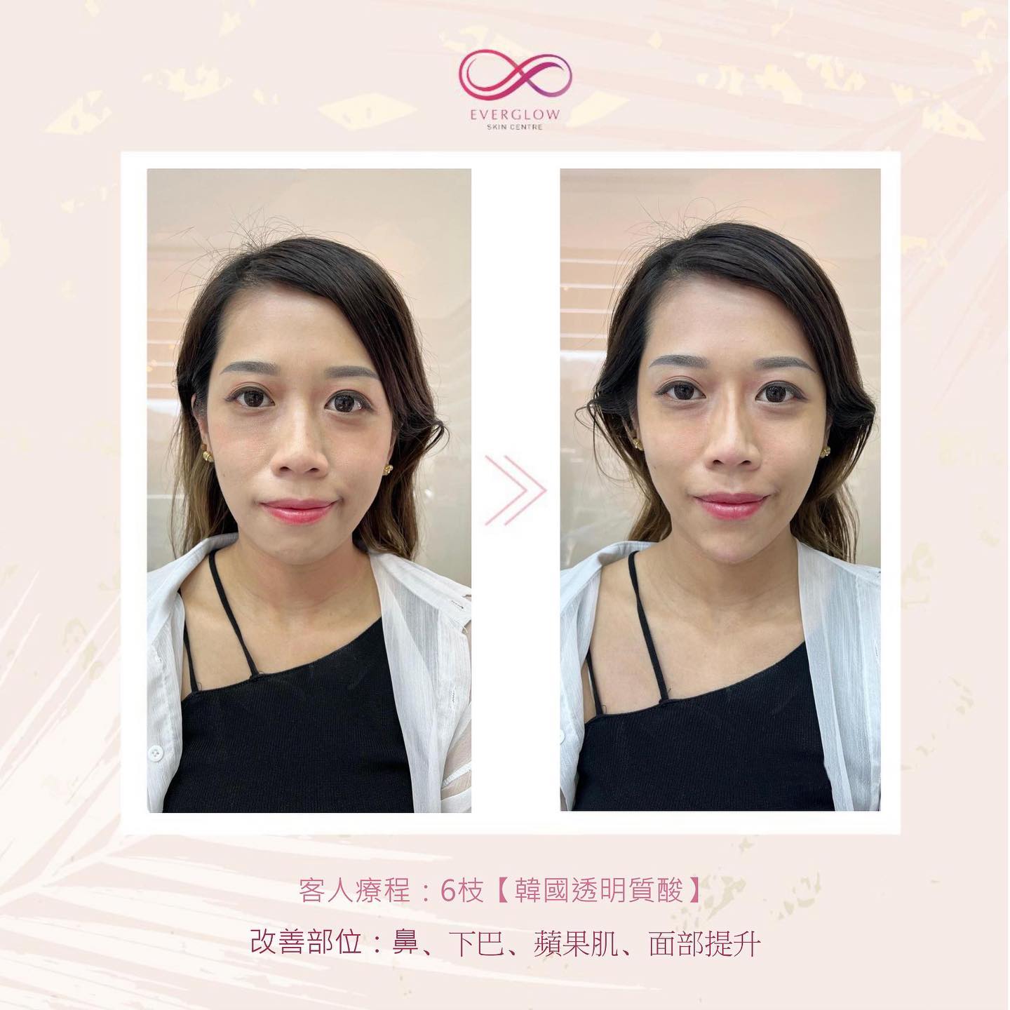 真實案例