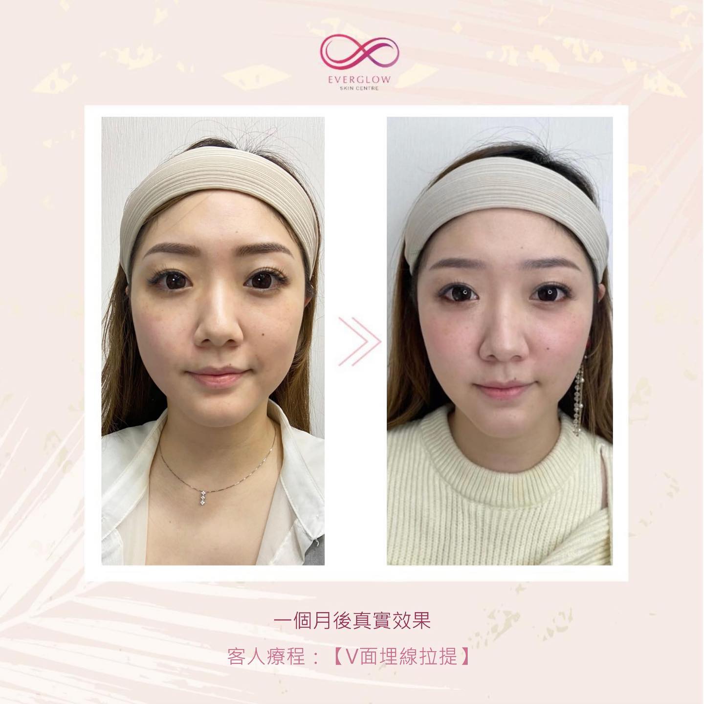 真實案例